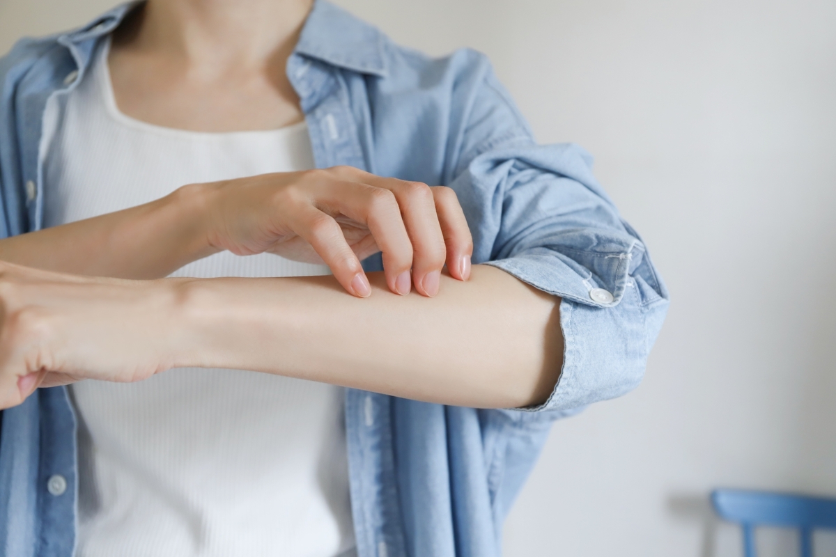 調剤薬局・薬剤師監修！子どもや若年層に多いアトピー性皮膚炎・アレルギーとお薬