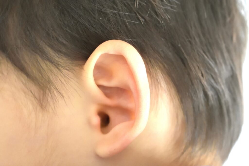 中耳炎とはどんな病気？子供がなりやすい理由