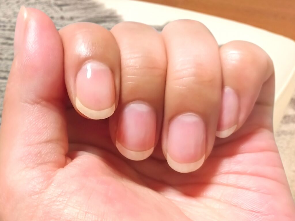 爪は健康状態を映す「鏡」