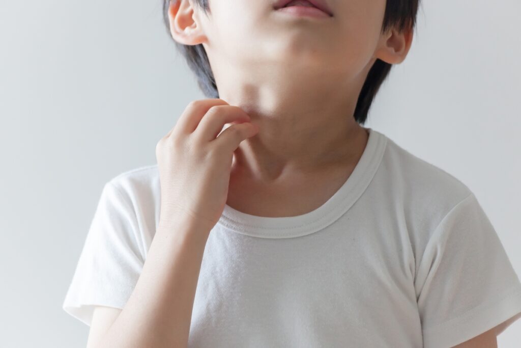 蚊に刺されたらかゆみ止めは使った方がよい?